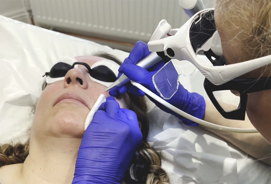 Clarendon laser skin therapy