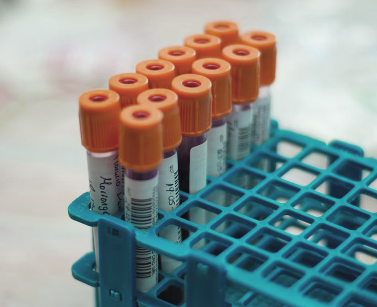 blood test