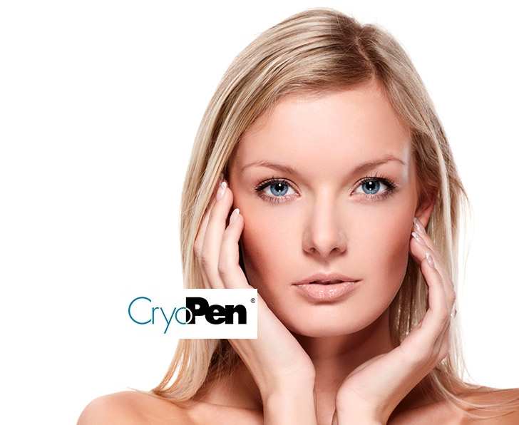 Cryopen skin treatment