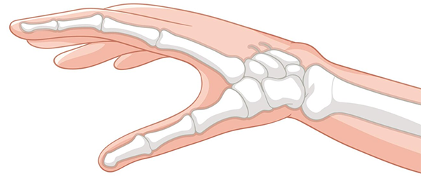 hand surgery poole