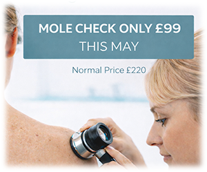 Mole Check Offer May