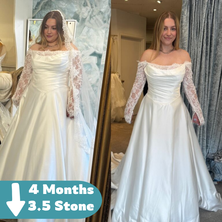 Patient-Before-and-After weight loss treatment